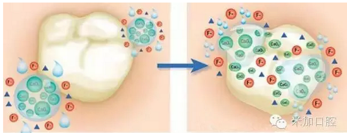 门诊常用的涂氟材料是德国进口多乐氟.